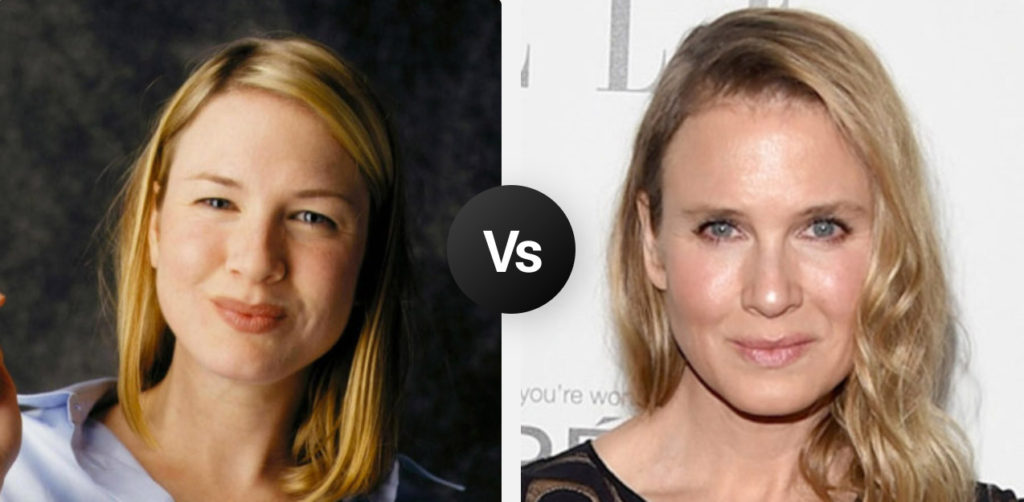 Before or After Images? - R Amazing!