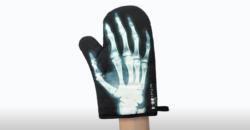 Amazing Oven Gloves - X-Ray