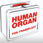 Amazing Lunch Boxes - Human Organ Transplant Lunch Box