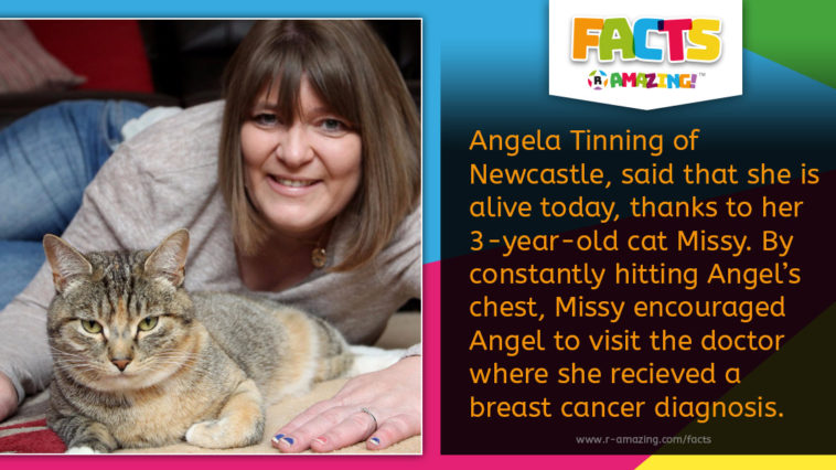 R-Amazing Facts- Cat Scan