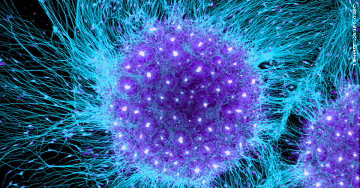 Amazing Microscopic Images - Human Brain Cell