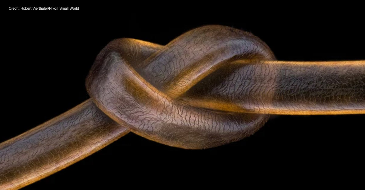 Amazing Microscopic Images - Human Hair