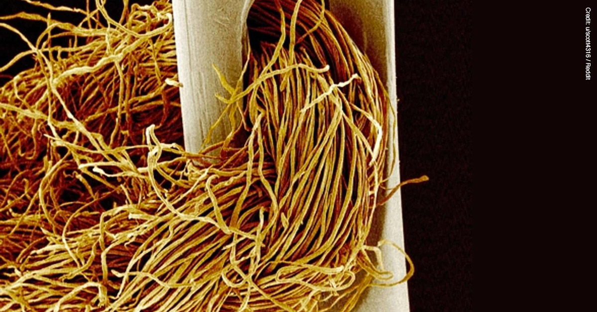 Amazing Microscopic Images - Needle and Thread