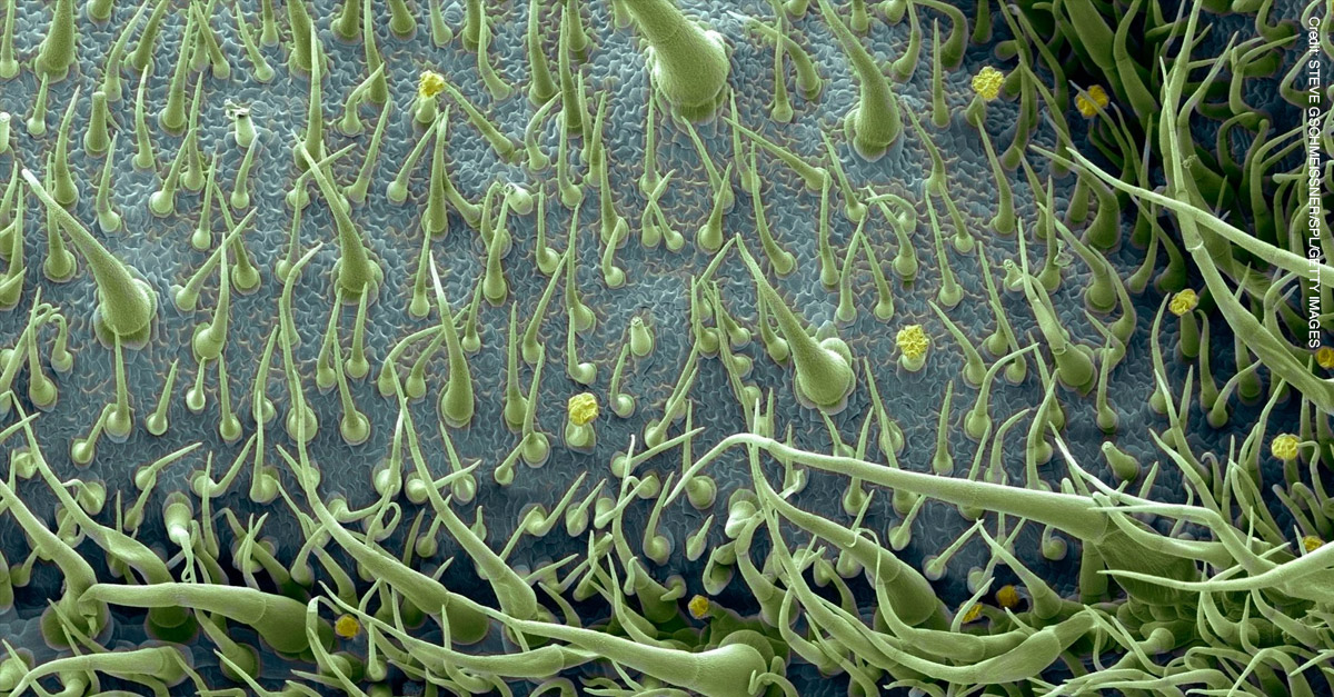 Amazing Microscopic Images - Tomato Leaf