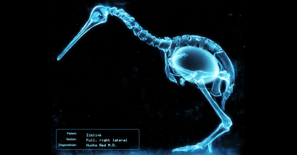 Amazing Kiwi Bird with Egg X-Ray