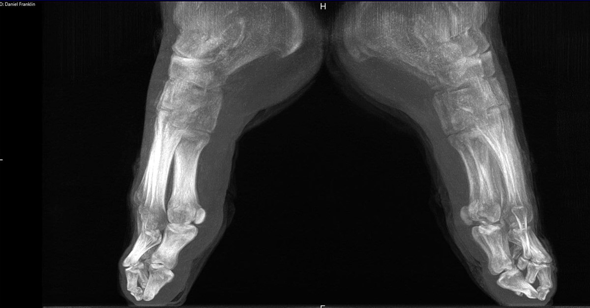 Amazing Ballerinas Feet X-Ray