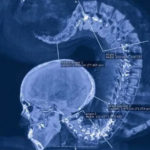 Amazing Gymnast X-Ray