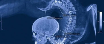 Amazing Gymnast X-Ray