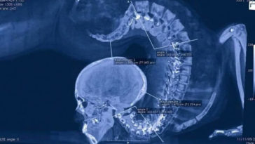 Amazing Gymnast X-Ray