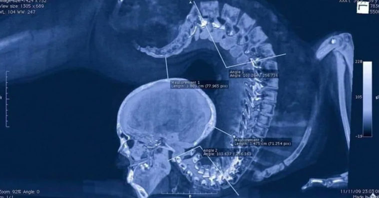 Amazing Gymnast X-Ray