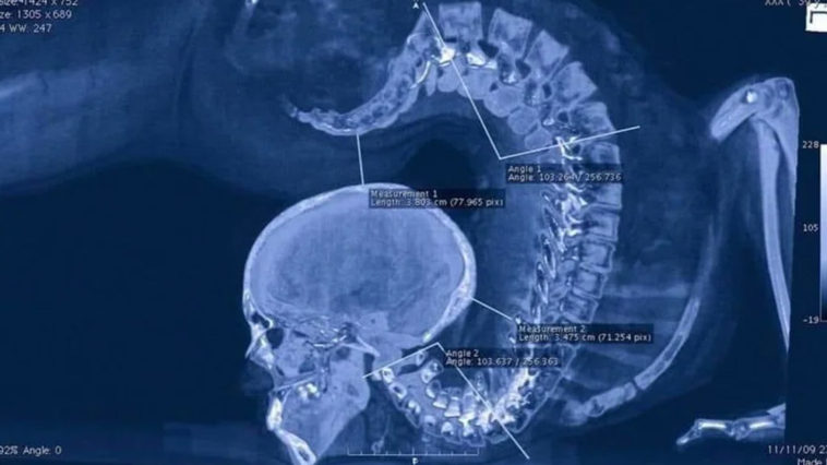 Amazing Gymnast X-Ray